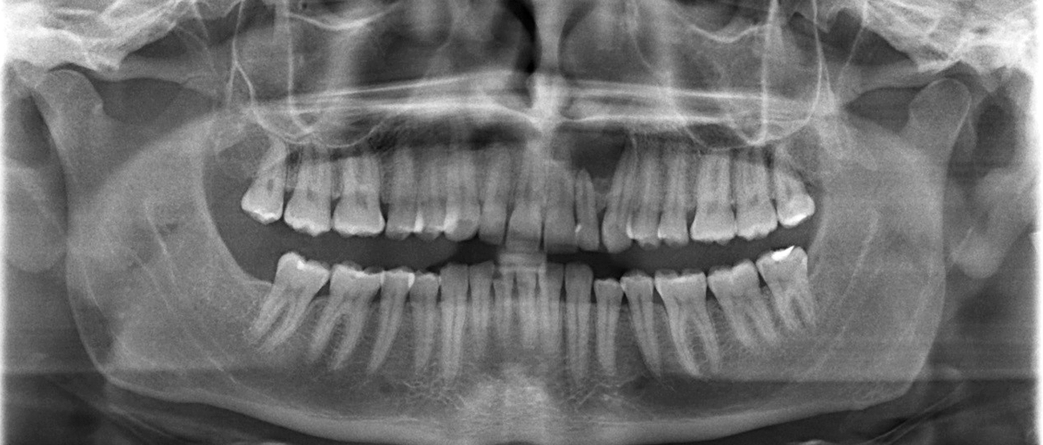 radiografias dentales